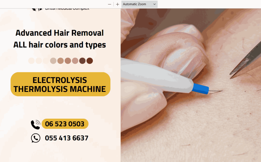 Thermolysis