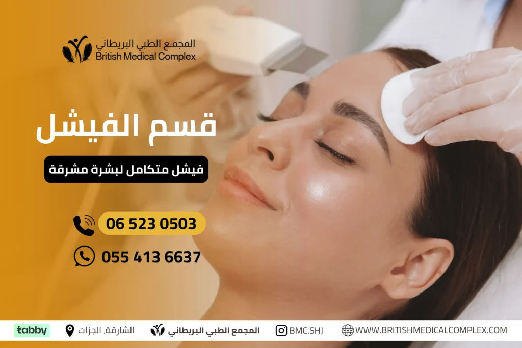 فيشل